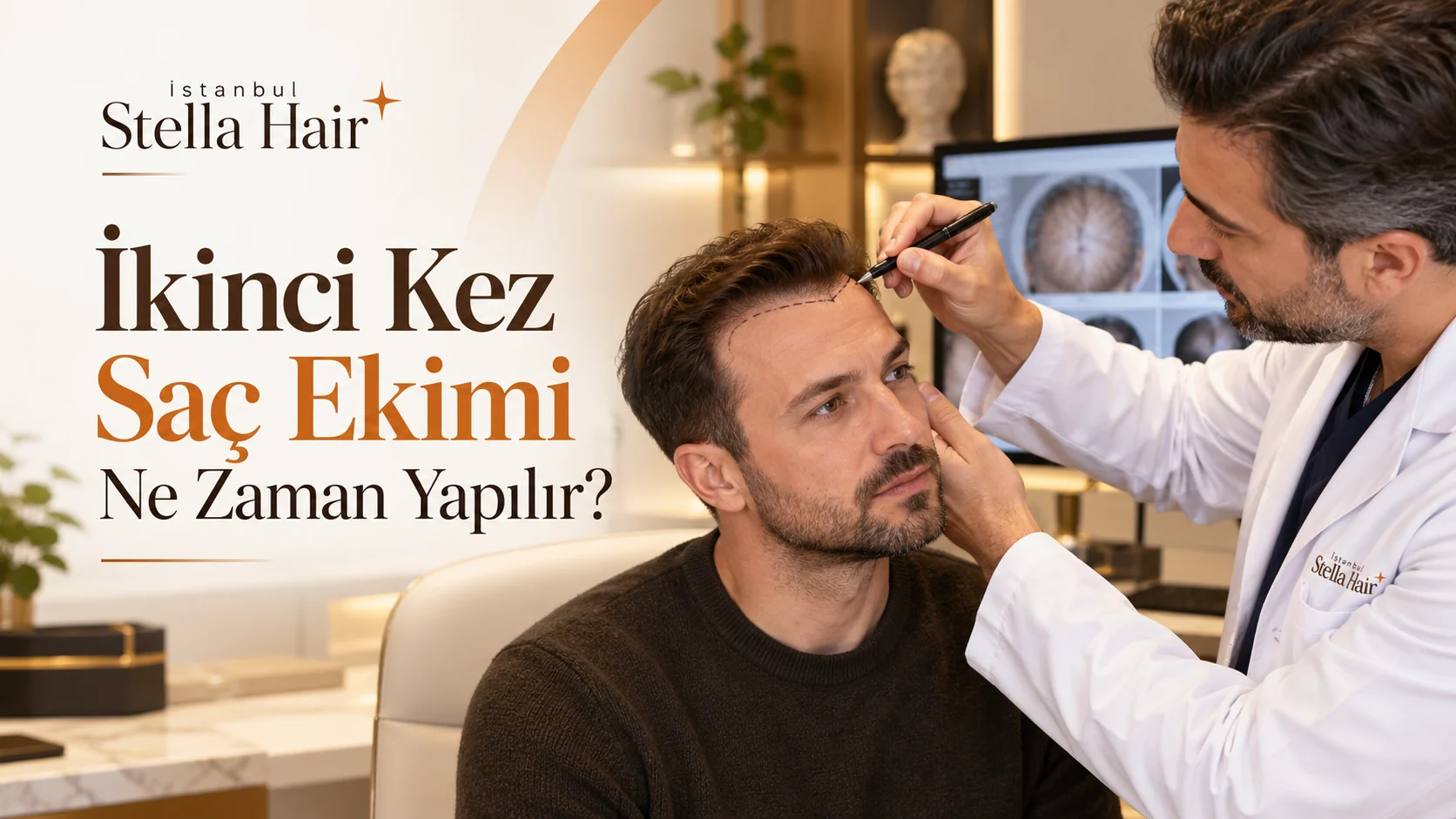 İkinci Kez Saç Ekimi Ne Zaman Yapılır?
