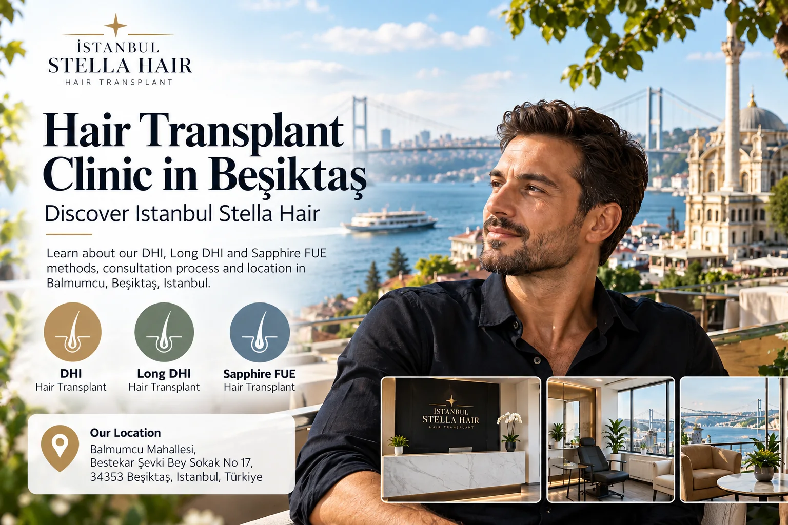 Hair Transplant Clinic in Beşiktaş – Discover Istanbul Stella Hair