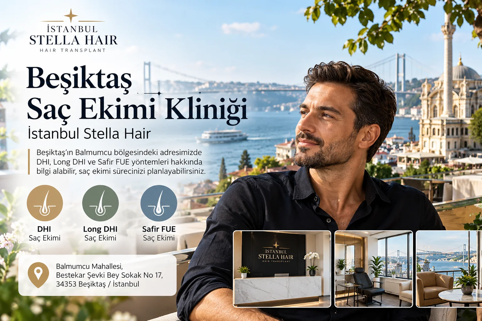 Beşiktaş Saç Ekimi Kliniği Araştıranlar İçin İstanbul Stella Hair