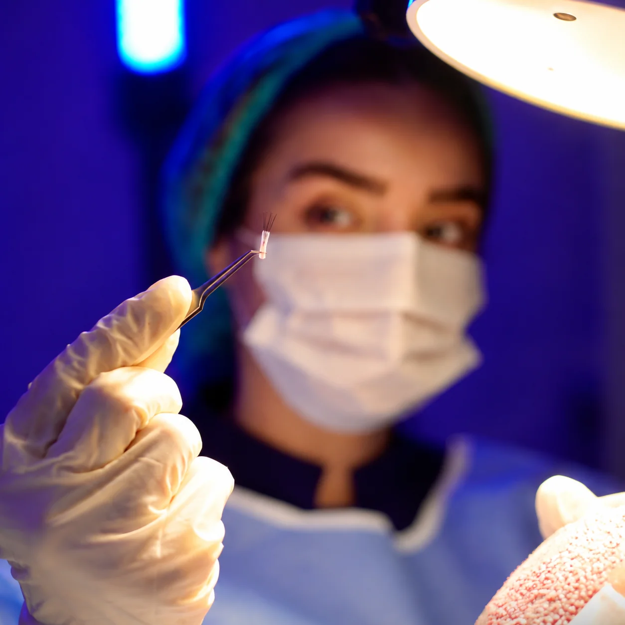 Hair graft preparation photo